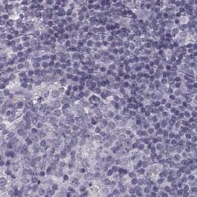 Immunohistochemistry-Paraffin: SLC28A2 Antibody [NBP2-33451]