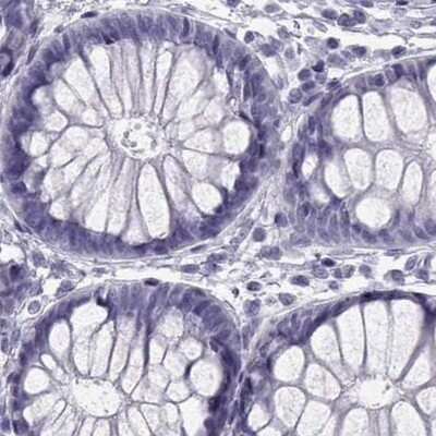 Immunohistochemistry-Paraffin: SLC28A2 Antibody [NBP2-33451]