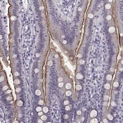 Immunohistochemistry-Paraffin: SLC28A2 Antibody [NBP2-38763]