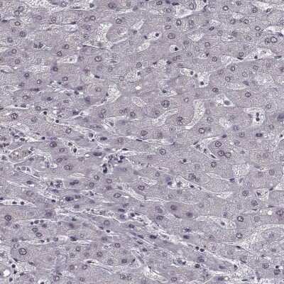 Immunohistochemistry-Paraffin: SLC28A2 Antibody [NBP2-38763]