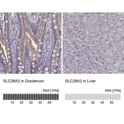 Immunohistochemistry-Paraffin: SLC28A2 Antibody [NBP2-38763]