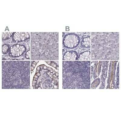 Immunohistochemistry-Paraffin: SLC28A2 Antibody [NBP2-38763]