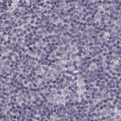 Immunohistochemistry-Paraffin: SLC28A2 Antibody [NBP2-38763]