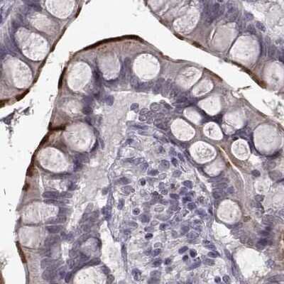 Immunohistochemistry-Paraffin: SLC28A2 Antibody [NBP2-38763]