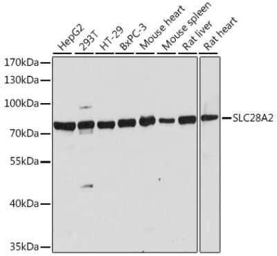 Western Blot: SLC28A2 AntibodyAzide and BSA Free [NBP2-93794]