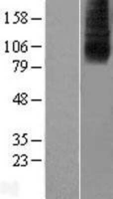 Western Blot: SLC28A2 Overexpression Lysate [NBL1-16086]