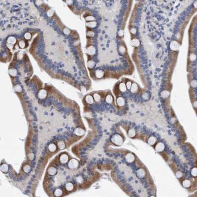 Immunohistochemistry-Paraffin: SLC28A3 Antibody [NBP1-84417]