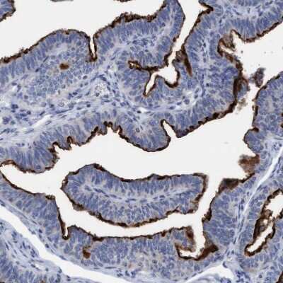 Immunohistochemistry-Paraffin: SLC28A3 Antibody [NBP1-84417]