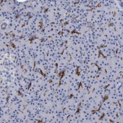 Immunohistochemistry-Paraffin: SLC28A3 Antibody [NBP1-84417]