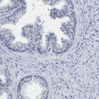 Immunohistochemistry-Paraffin: SLC28A3 Antibody [NBP1-84417]