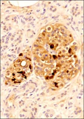Immunohistochemistry-Paraffin: SLC28A3 Antibody [NBP2-29615]