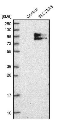 Western Blot: SLC28A3 Antibody [NBP1-84418]