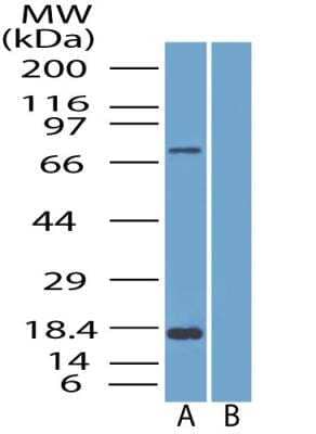 Western Blot: SLC28A3 Antibody [NBP2-29615]