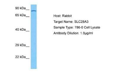 Western Blot: SLC28A3 Antibody [NBP2-88294]