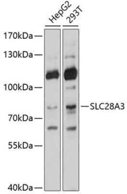 Western Blot: SLC28A3 AntibodyBSA Free [NBP2-93439]