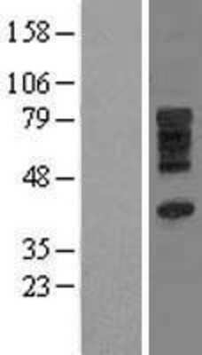 Western Blot: SLC28A3 Overexpression Lysate [NBL1-16087]