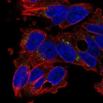 Immunocytochemistry/ Immunofluorescence: SLC29A3 Antibody [NBP2-58806]