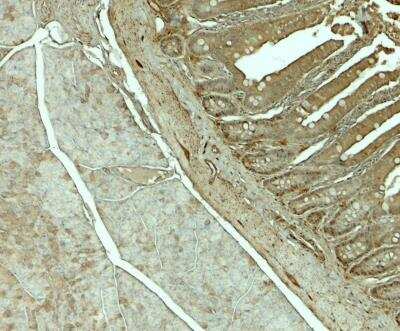 Immunohistochemistry: SLC29A3 Antibody - BSA Free [NBP2-81829]