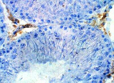 Immunohistochemistry-Paraffin: SLC29A3 Antibody [NBP3-12347]