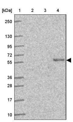 Western Blot: SLC29A3 Antibody [NBP2-31589]