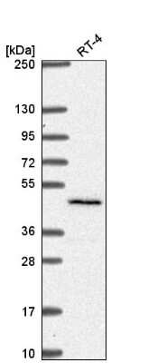 Western Blot: SLC29A3 Antibody [NBP2-58230]