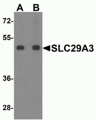 Western Blot: SLC29A3 AntibodyBSA Free [NBP2-81829]