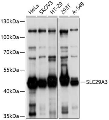 Western Blot: SLC29A3 AntibodyBSA Free [NBP2-93466]