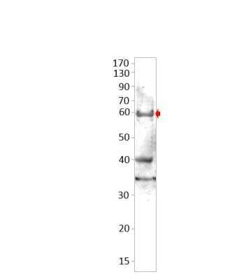 Western Blot: SLC29A3 Antibody [NBP3-12347]