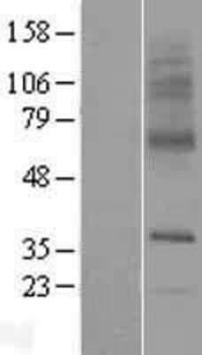 Western Blot: SLC29A3 Overexpression Lysate [NBP2-06813]