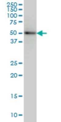 Western Blot: SLC29A4 Antibody (6B6) [H00222962-M03]