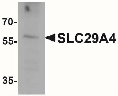 Western Blot: SLC29A4 AntibodyBSA Free [NBP2-41314]