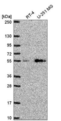 Western Blot: SLC29A4 Antibody [NBP2-55497]