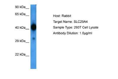 Western Blot: SLC29A4 Antibody [NBP2-88296]