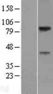 Western Blot: SLC29A4 Overexpression Lysate [NBP2-05279]