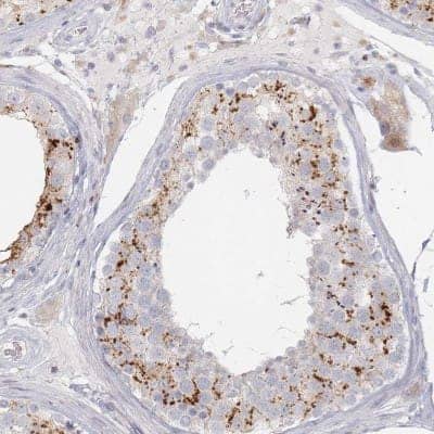 Immunohistochemistry: SLC2A11 Antibody [NBP2-33382]