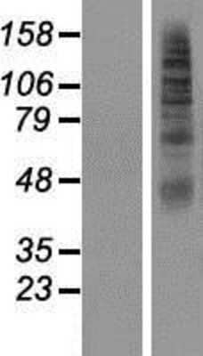 Western Blot: SLC2A11 Overexpression Lysate [NBP2-08645]