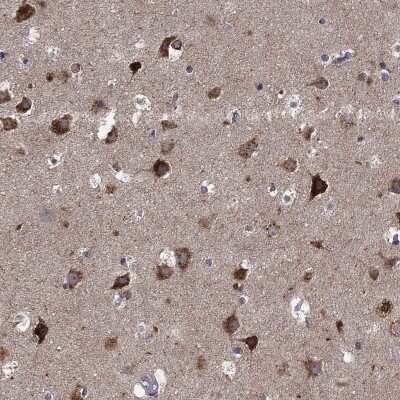 Immunohistochemistry-Paraffin: SLC2A13 Antibody [NBP3-17114]
