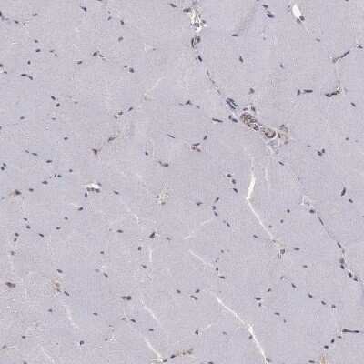 Immunohistochemistry-Paraffin: SLC2A13 Antibody [NBP3-17114]