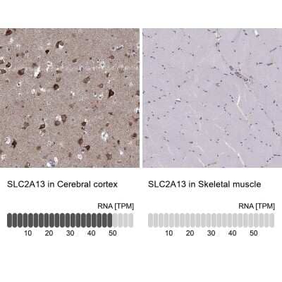 Immunohistochemistry-Paraffin: SLC2A13 Antibody [NBP3-17114]