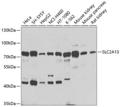 Western Blot: SLC2A13 AntibodyBSA Free [NBP2-94351]