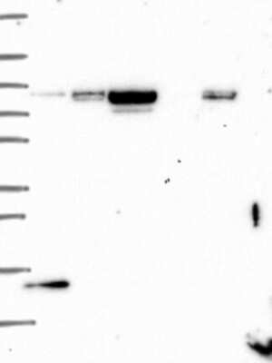 Western Blot: SLC2A13 Antibody [NBP3-17114]