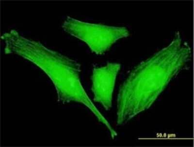 Immunocytochemistry/ Immunofluorescence: SLC2A4RG Antibody (5D2) [H00056731-M01]