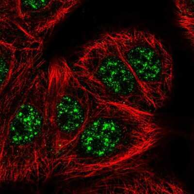 Immunocytochemistry/ Immunofluorescence: SLC2A4RG Antibody [NBP2-57221]