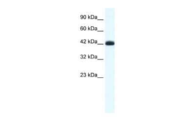 Western Blot: SLC2A4RG Antibody [NBP2-88297]