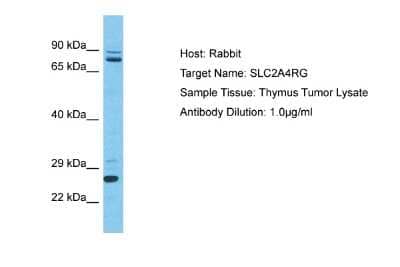 Western Blot: SLC2A4RG Antibody [NBP2-88299]