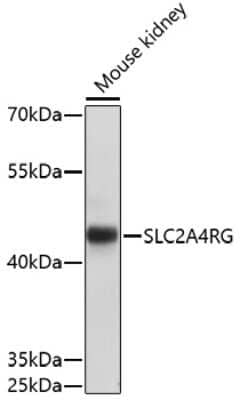 Western Blot: SLC2A4RG AntibodyAzide and BSA Free [NBP2-93156]