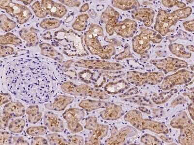 Immunohistochemistry-Paraffin: SLC2A7 Antibody [NBP2-98131]