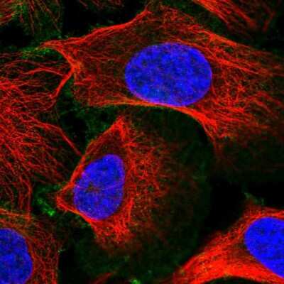 Immunocytochemistry/ Immunofluorescence: SLC30A1 Antibody [NBP2-54987]