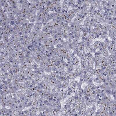 Immunocytochemistry/ Immunofluorescence: SLC30A10 Antibody [NBP2-68817]