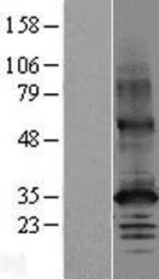 Western Blot: SLC30A2 Overexpression Lysate [NBP2-06015]